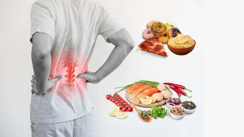 تغذیه و رژیم غذایی مناسب برای کاهش التهاب و درمان دیسک کمر | دکتر امیر قنبریان | درمان دیسک کمر اصفهان