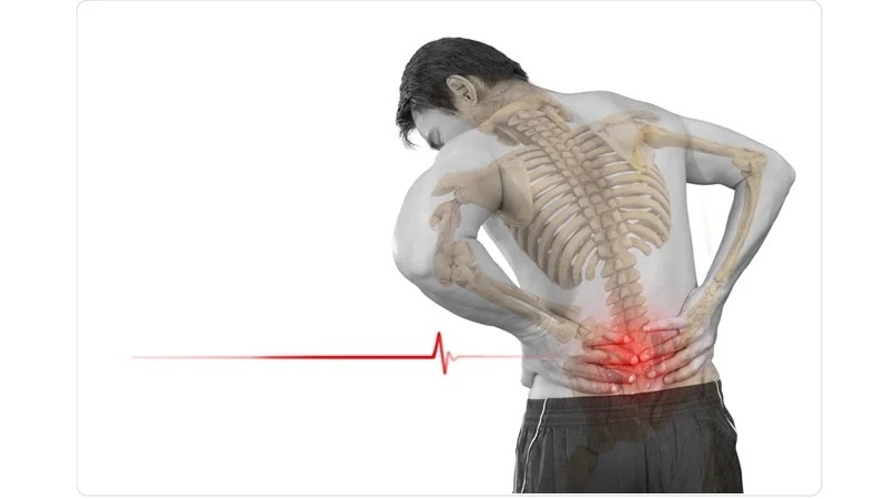 دیسک کمر چیست؟ | درمان دیسک کمر اصفهان | دکتر امیر قنبریان