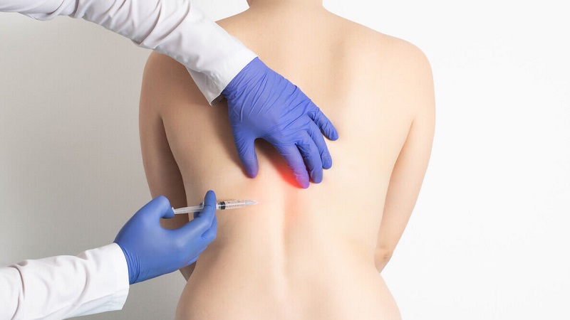 مقایسه درمان دیسک کمر با لیزر، اوزون‌تراپی و تزریق PRP | دکتر امیر قنبریان | درمان دیسک کمر اصفهان
