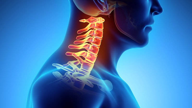 درمان‌ شکستگی مهره گردن | درمان دیسک کمر اصفهان