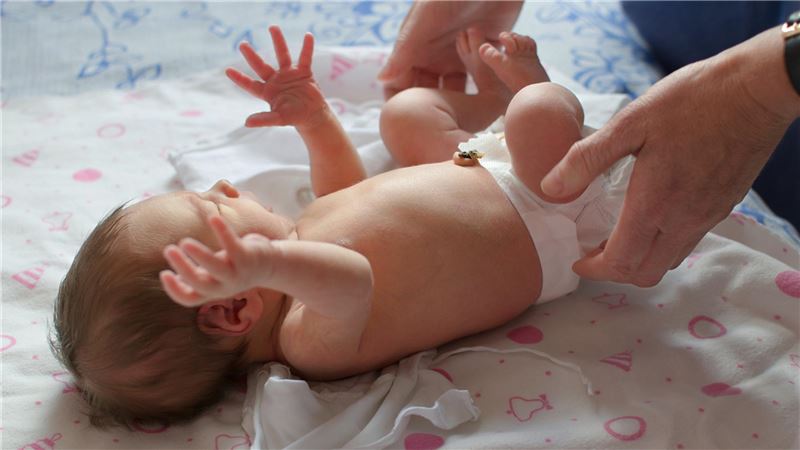 تشخیص و دمان دررفتگی لگن در نوزادان | درمان دیسک کمر اصفهان