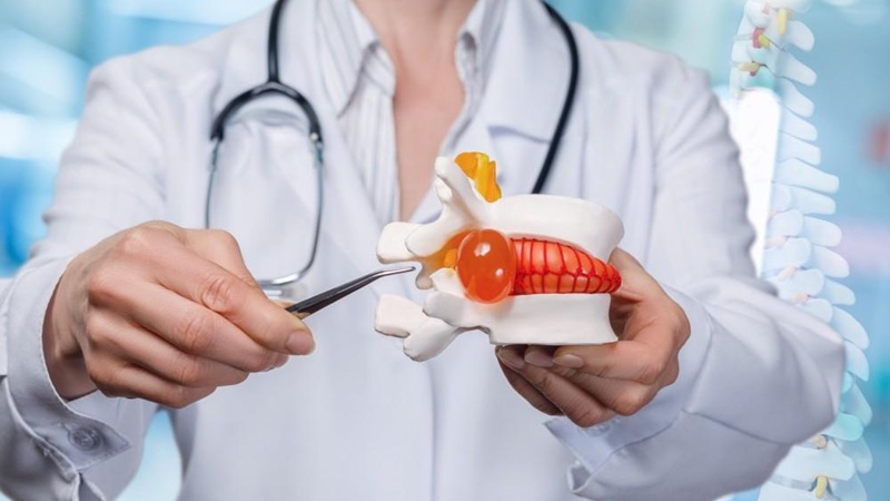 درمان دستی ستون فقرات برای بازگرداندن دیسک بیرون‌زده به جای خود | لیزر جای جوش در تهران | دکتر مهدی سبکتکین