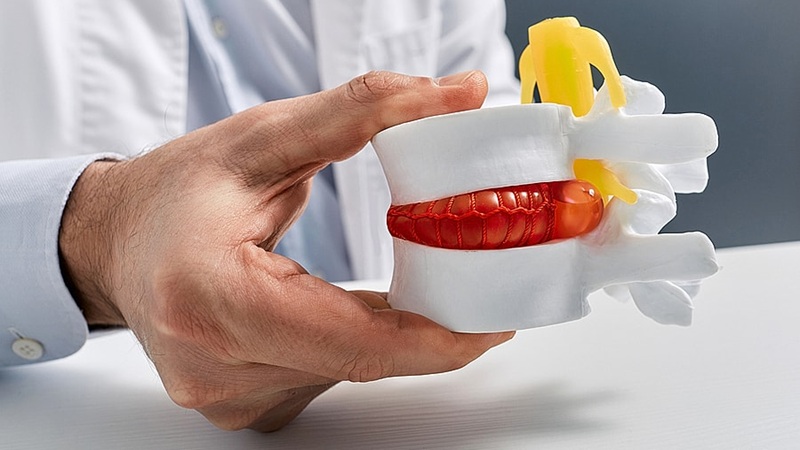 درمان دیسک کمر اصفهان | دکتر امیر قنبریان